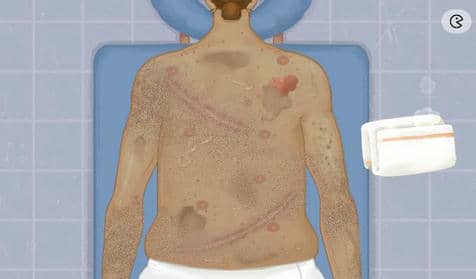 《收纳达人》背部护理怎通关方法技巧